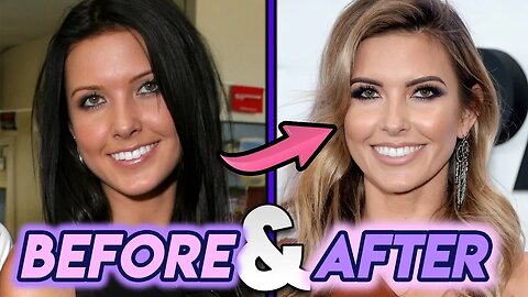 Audrina Patridge | Before and After | The Hills Star Plastic Surgery Transformation