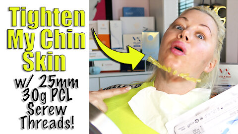 Tighten Chin Skin with 25mm 30g PCL Screw Threads from acecosm.com | Code Jessica10 Saves you Money!