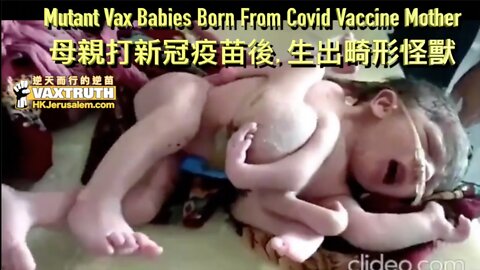 被禁片 : 難以置信！真正的「怪獸家長」出現了！逆苗媽媽生出怪獸畸胎！Banned Video: Mutant Vax Babies gave birth by a Covid Vaccine Mother！