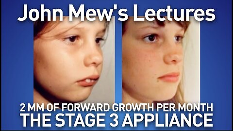 John Mew's lectures part 20: the stage 3 appliance