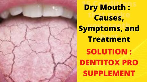 Dry Mouth: Causes, Symptoms, and Treatment