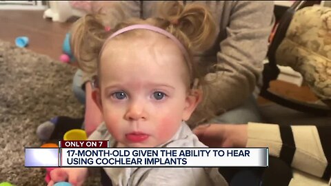 Toddler given the ability to hear using cochlear implants