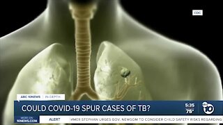 SDSU researcher warns COVID-19 could cause spike in tuberculosis cases
