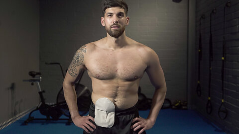 Personal Trainer 'Proud' Of His Stoma Bag | SHAKE MY BEAUTY
