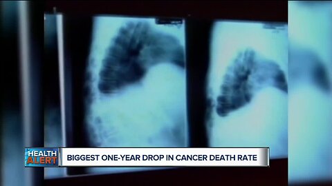 Ask Dr. Nandi: Cancer death rate posts biggest one-year drop ever