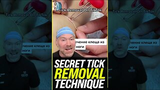 Secret Tick Removal Technique 🤫 #shorts