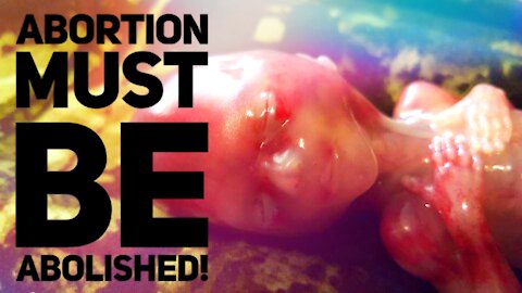ABORTION MUST BE ABOLISHED - Fauci Funding Scalped Baby Experiments