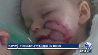 'This can't be happening:' Family of girl mauled twice by dog says animal control doing nothing