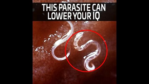 Hookworms Can Lower A Human's IQ | Dr. Jason Dean