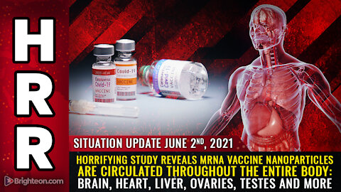 Situation Update, 6/2/21 - HORRIFYING STUDY about mRNA vaccine nanoparticles.