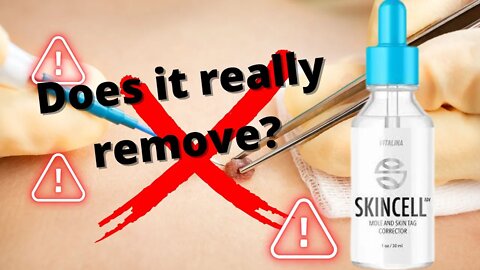 Skincell Advanced Reviews - WILL IT REMOVE? Skincell does it work? Skincell Skincell Advanced Review
