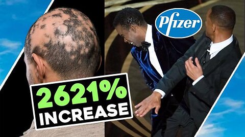 Oct 06, 2022 Pfizer SLAP Stunt HAIR LOSS 2621% ⬆ INCREASE / Hugo Talks