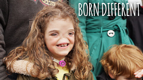 The Girl Born Without A Nose | BORN DIFFERENT