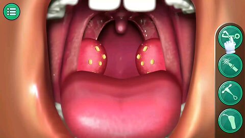 ASMR Tonsil Surgery Animation_ Multi Surgery Hospital/Animation Surgery #surgery #hospital #asmr