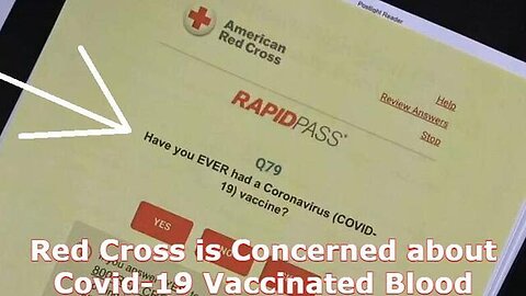 Eligible for Blood Donation? Red Cross is Concerned about Covid-19 Vaccinated Blood