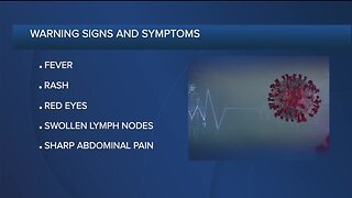 CDC issues warning on mysterious COVID-19-linked syndrome that affects children