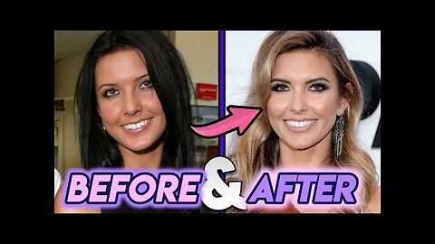 Audrina Patridge | Before and After | The Hills Star Plastic Surgery Transformation