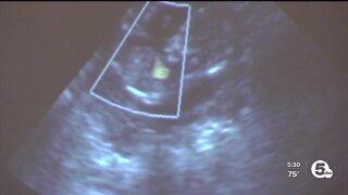 Pro-life supporters react to Roe v. Wade reversal, set goal of ending abortion in Ohio