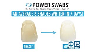 Want whiter teeth? Try Power Swabs TODAY!