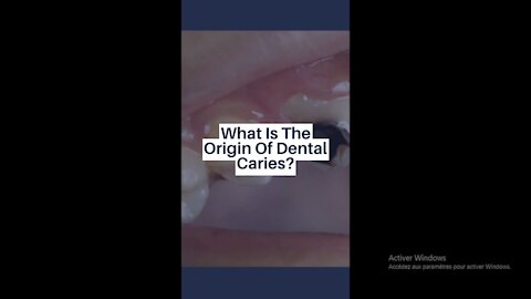What Is The Origin Of Dental Caries??