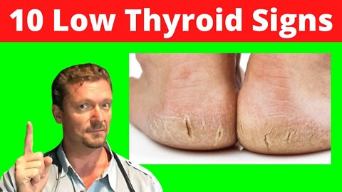 10 Skin Signs of LOW THYROID (Skin Signs of Hypothyroidism) 2022