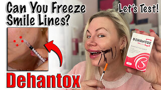 Can You Freeze your Smile Lines with Tox? Let's Test with Dehantox, Acecosm | Code Jessica10