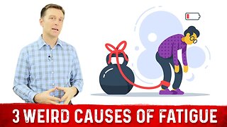 3 Weird Causes of Chronic Fatigue – Dr.Berg