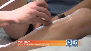 Legs crawling with spider or varicose veins? Discover the Vein Envy difference TODAY