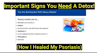 Important Signs You Need A Detox! (How I Healed My Psoriasis)