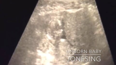 Unborn Baby | JoneSings (Piano Version)