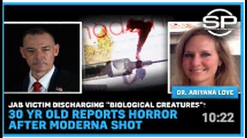 Jab Victim Discharging "Biological Creatures" 30 Yr Old Reports HORROR After Moderna Shot