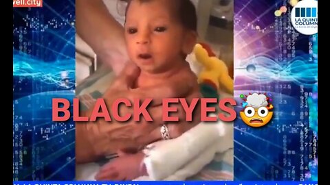 THE BLACK EYED BABIES (PANDEMIC VACCINATED BABIES)