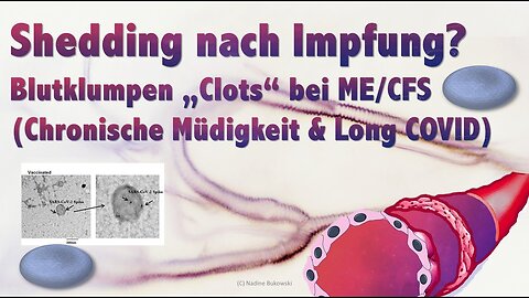 German Video About Spike Protein Shedding from the mRNA Vaccines (ENG Subtitles)