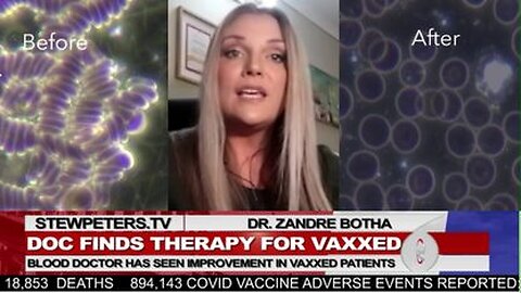 Dr. Zandre Botha: Therapy For "VAX" Victims! Massive Improvement in Blood! - 12/3/21