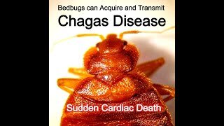 Bed Bugs Transmit Chagas Sudden Cardiac Death