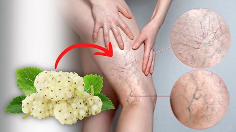 The Tea From This Fruit Can Make Varicose Veins Disappear