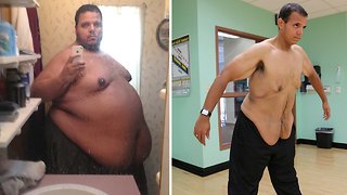 Troll To Swole: Internet Bully Loses 400lbs After Changing His Ways