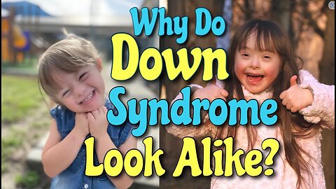 Why Do Down Syndrome People Look Alike? **UPDATED**
