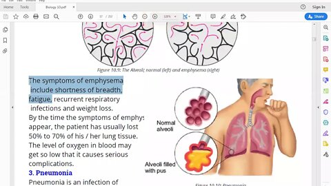 Class 10th Biology Emphysema & Pneumonia Lecture 8 Zoom Online 7 July 2020