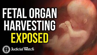 “CHOP SHOP” Fetal Organ Harvesting Exposed!