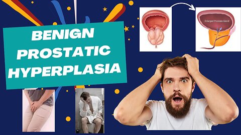 Benign Prostatic Hyperplasia (BPH) | Urine Dribbling | Urine Dribbling Treatment