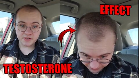 TRANS MAN TAKING TESTOSTERONE HAS REGRETS