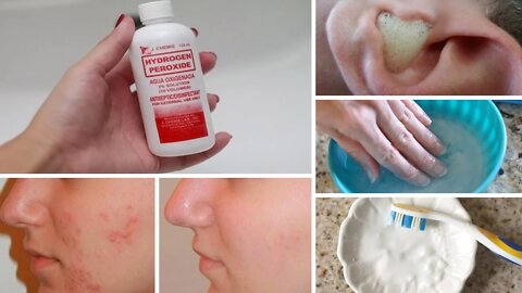 7 Surprising Uses for Hydrogen Peroxide