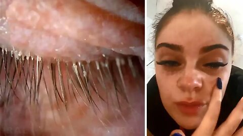 Here Is How Eyelash Extensions Can Go Horribly Wrong