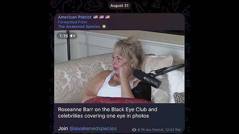 Roseanne Barr on the Black Eye Club and celebrities covering one eye in photos
