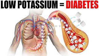 Potassium Deficiency Causes Diabetes