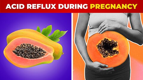 How to Naturally Treat Acid Reflux During Pregnancy
