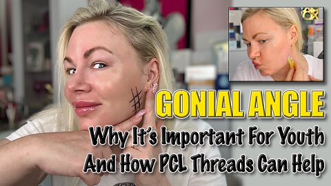 How PCL Screw Threads Help the Genial Angle, AceCosm | Code Jessica10 Saves you Money