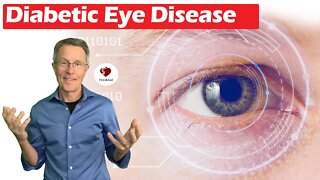 Diabetic Eye Disease - It's Not Just For Diabetics