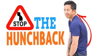 How to Prevent Hunchback Posture - FIX KYPHOSIS BEFORE IT STARTS